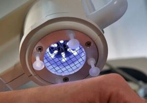 زخمهای دیابت با تابش پلاسمای سرد دستگاه دانش بنیان ایرانی درمان میشود